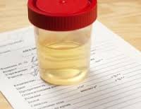 Dilute Specimens in Employer Drug Testing