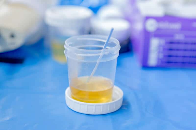 Urine Alcohol Test